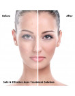 Trądzik Remover pryszcz łatka naklejki usuwania znaczników twarzy Spot twarzy do pielęgnacji skóry OA66