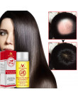 Wysokiej Quality2019 Powful produkty stymulujące porost włosów imbir szybciej rosną szampon do włosów zatrzymaj wypadanie włosów