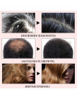 Wysokiej Quality2019 Powful produkty stymulujące porost włosów imbir szybciej rosną szampon do włosów zatrzymaj wypadanie włosów