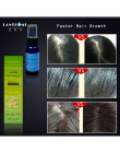 Unikalne szybka Sunburst produkty stymulujące porost włosów gęste włosy odrastają Essence leczenie wypadania włosów dla kobiet i