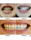 10 ml Dental Clareador wybielanie zębów narzędzia stomatologii Dental Odontologia bull terrier do pielęgnacji zębów wody higiena
