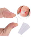Wrastający palec u nogi naklejki Patch Paronychia korektor jest twój plik elastyczna łatka korektor pielęgnacja stóp leczenie Pe