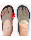 1 para zespół cieśni kanału nadgarstka skarpety żelowe palucha koślawego urządzenie stóp ból łagodzi duży separator palców stopy